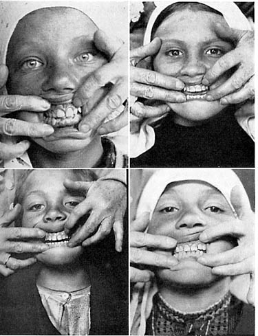 teeth teeth
